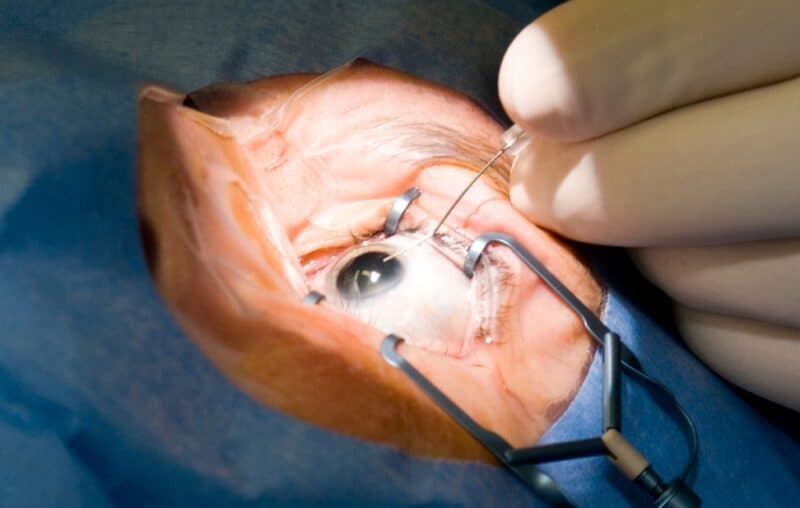 treat options for cataract and blindness